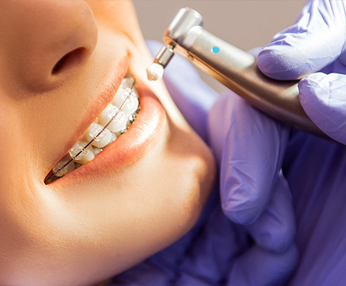 Takoj obiščite zobozdravnika.